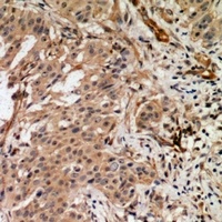 Anti-RAB3GAP2 Antibody