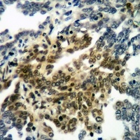 Anti-RANBP17 Antibody