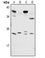 RAB1B Antibody
