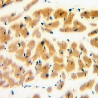 RAB1B antibody