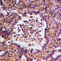 Anti-RGS14 Antibody