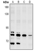 NEK5 Rabbit Polyclonal Antibody