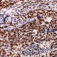 Anti-PDIK1L Antibody