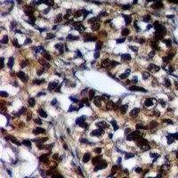 Anti-PLK2 Antibody