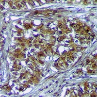 Anti-PLK3 Antibody
