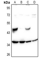 SH2D5 Rabbit Polyclonal Antibody