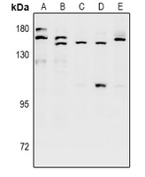 SH3TC1 Rabbit Polyclonal Antibody