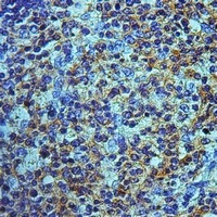 Anti-OATP2 Antibody