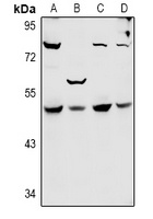 SYT11 Rabbit Polyclonal Antibody
