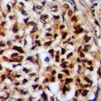 Anti-Granuphilin Antibody