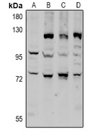CD6 Rabbit Polyclonal Antibody