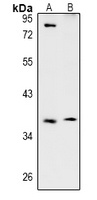 TSSK4 Rabbit Polyclonal Antibody
