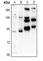 PTPN22 Antibody