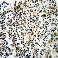 PTPN22 Antibody
