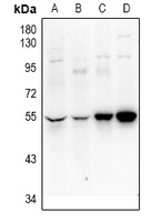 UEVLD Antibody