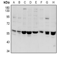 VANGL1 Rabbit Polyclonal Antibody