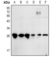 ZNF575 Antibody