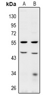 BRE Rabbit Polyclonal Antibody