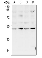 ZAC Rabbit Polyclonal Antibody