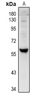 Cytochrome P450 4V2 Rabbit Polyclonal Antibody