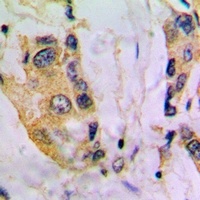 Cytochrome P450 4V2 Rabbit Polyclonal Antibody