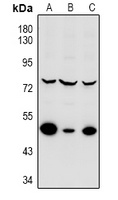 MNK2 Rabbit Polyclonal Antibody