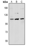 Desmoglein 1 Rabbit Polyclonal Antibody