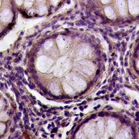 Anti-Desmoglein 1 Antibody
