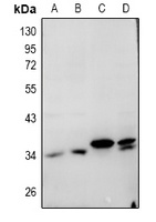 Cathepsin L Rabbit Polyclonal Antibody
