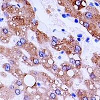 Cathepsin L Rabbit Polyclonal Antibody