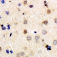 Anti-DPP7 Antibody