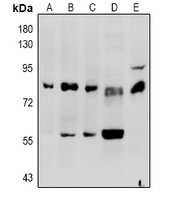 Factor II Rabbit Polyclonal Antibody