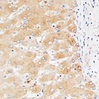Anti-Factor II Antibody