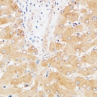 Anti-Hepassocin Antibody