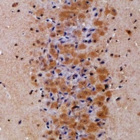 Anti-Prolyl Endopeptidase Antibody
