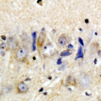 Anti-CD354 Antibody