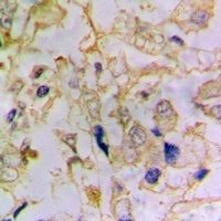 Anti-DFF45 Antibody
