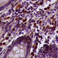 Anti-Acrosin Antibody