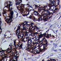 Anti-ADAM10 Antibody