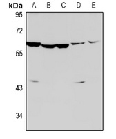 Caspase 8 (Cleaved-D384) Antibody