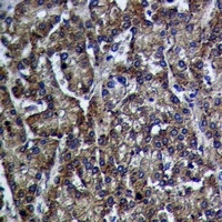 Cathepsin D Rabbit Polyclonal Antibody