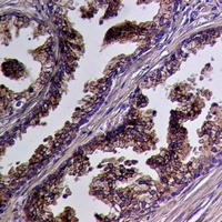 Anti-Cathepsin H Antibody