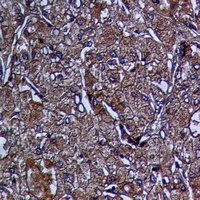Cathepsin L HC Antibody