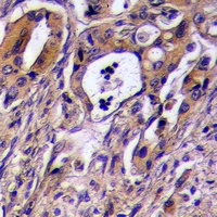 Anti-CD97 alpha Antibody