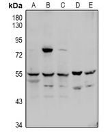 Factor X LC Rabbit Polyclonal Antibody