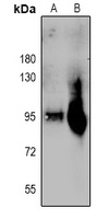 Plasminogen HC A Rabbit Polyclonal Antibody