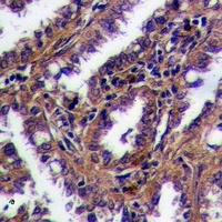 Anti-GPR169 Antibody