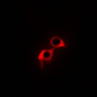 Anti-GPR169 Antibody