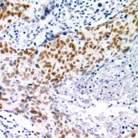 CHK2 Rabbit Polyclonal Antibody