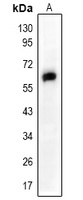 SMAD2 Rabbit Polyclonal Antibody